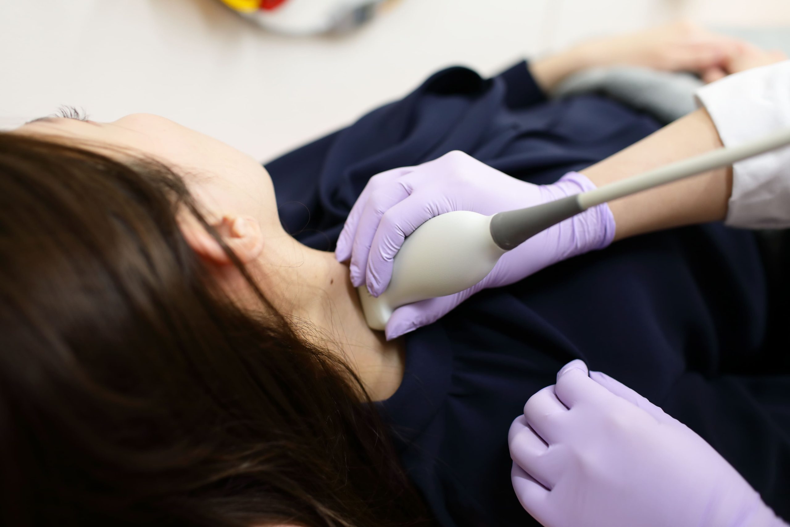 亜急性甲状腺炎の治療